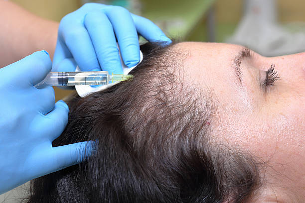 istock Anti hair loss injection in clinic. 542206252