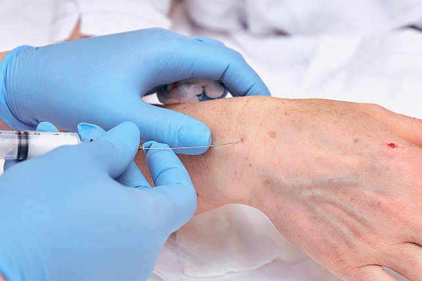 istock Anti-age injection therapy. Hand rejuvenation. 542206308