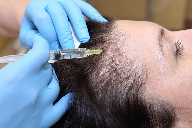 istock Anti hair loss injection in clinic. 542207748