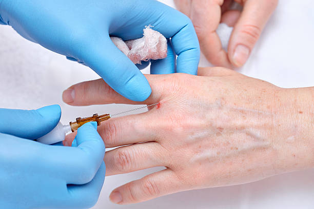 istock Anti-age injection therapy. Hand rejuvenation. 542207818