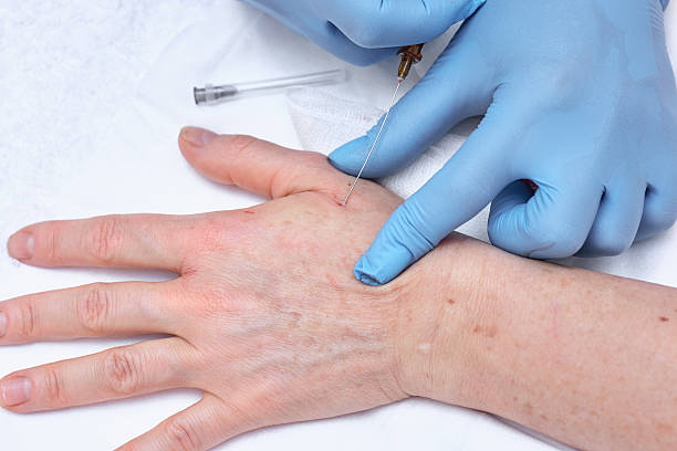 istock Anti-age injection therapy. Hand rejuvenation. 542207860