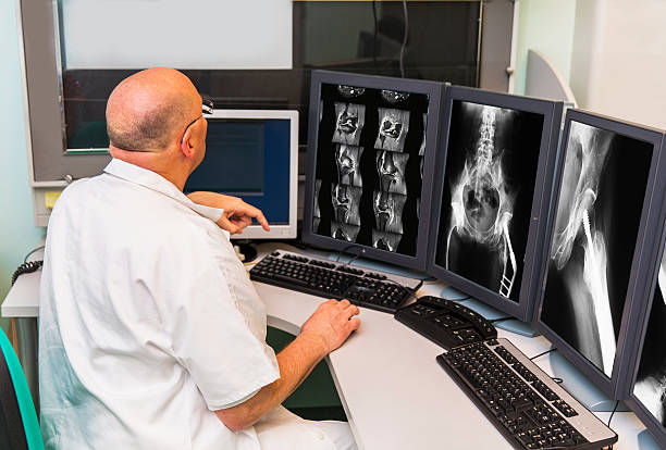 수석 대한 방사선 종양학 도입하십시오 examing mri 스캔) - human spine mri scan x ray doctor 뉴스 사진 이미지