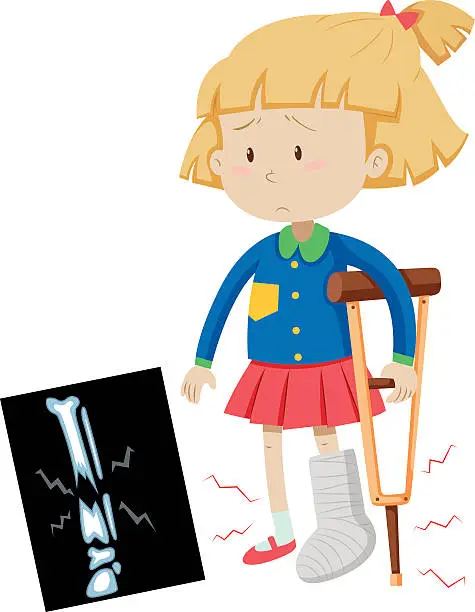 Vector illustration of Little girl with broken leg