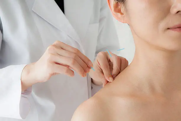Women receiving acupuncture treatment for beauty