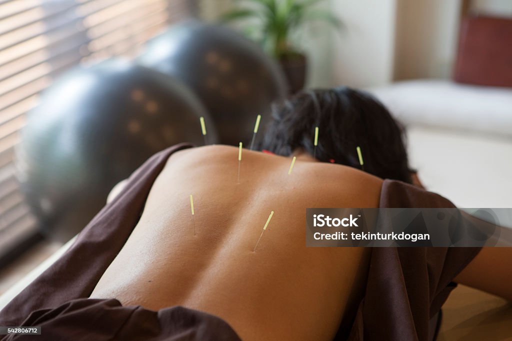 japanese female get acupuncture treatment in kyoto japan Acupuncture Stock Photo
