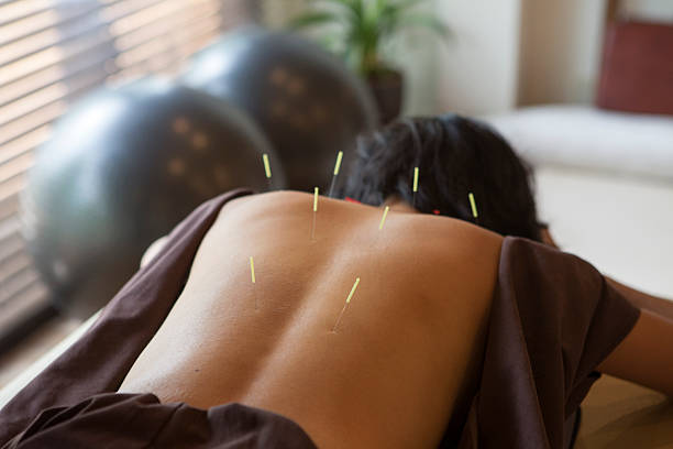 japanese female get acupuncture treatment in kyoto japan japanese female get acupuncture treatment in kyoto japan acupuncture photos stock pictures, royalty-free photos & images