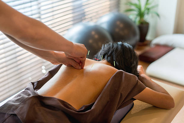 Woman at the acupuncturist Woman at the acupuncturist and doctor placing needles on her back - alternative medicine concepts acupuncture photos stock pictures, royalty-free photos & images