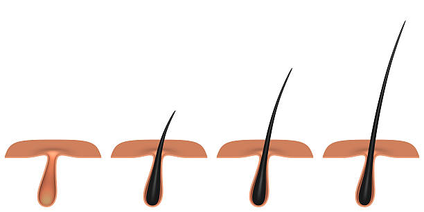 istock hair follicle. cross section. 542939740