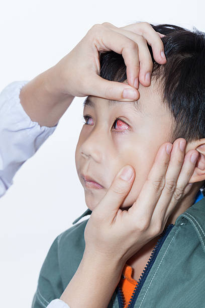 pinkeye (zapalenie spojówek) zakażenie na chłopca, lekarz sprawdzić oko - conjunctivitis sore eyes child human eye zdjęcia i obrazy z banku zdjęć