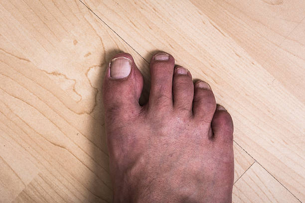 istock Human white foot on a wooden floor 543462822