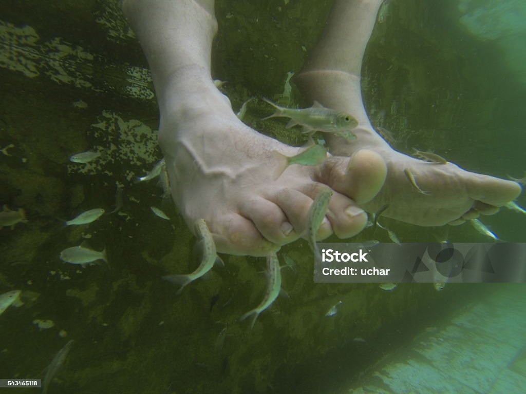 doctor fish 'Doctor fish' eat the dead skin off ofpsoriasis patient as part of his treatment on  in Kangal, 105 kilometers south of the central Turkish city of Sivas. The fish, known also as gara ruffa obtusa, found in naturally occurring mineral-rich springs are used as treatment for patients with psoriasis and skin ailments, eating away at diseased skin. Patients suffering from psoriasis travel from all over the world to Kangal to bathe in the pools for treatment. Animal Themes Stock Photo