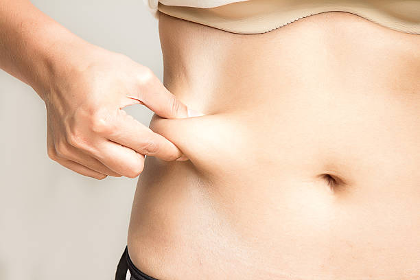 woman measuring her belly fat with her hands close up - liposuction imagens e fotografias de stock
