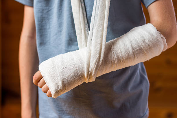 Boy with an arm in plaster Boy with an arm in plaster in the brown background, accident at home , injury, trauma concept  plaster stock pictures, royalty-free photos & images