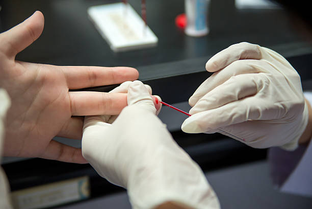 prélèvement de sang en tube capillaire - test du sida photos et images de collection