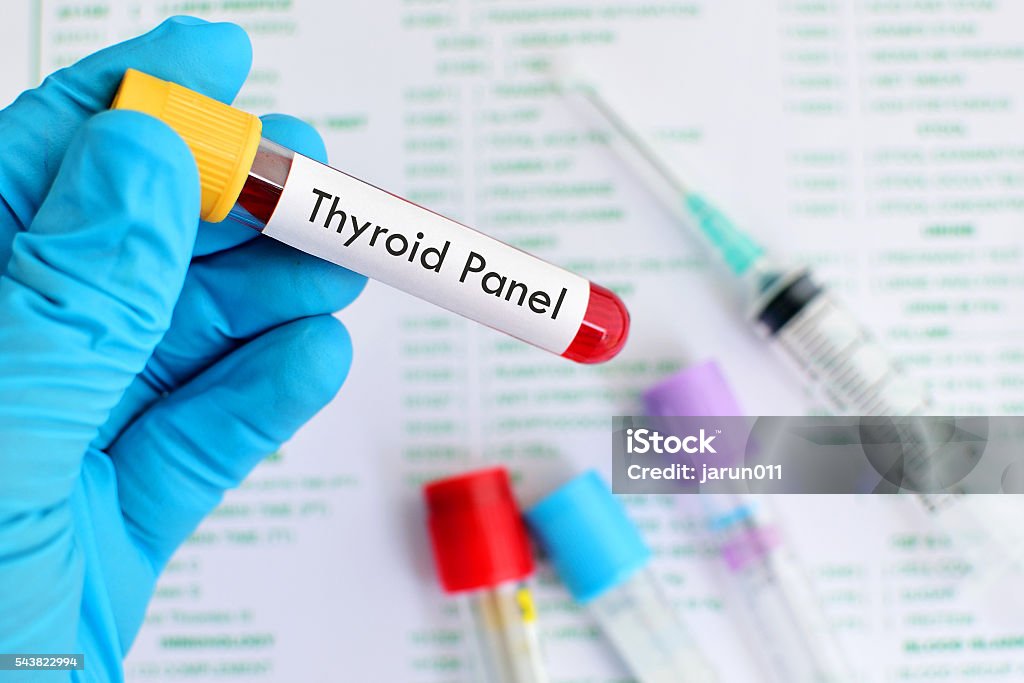 Thyroid panel test Blood sample for thyroid panel test Blood Stock Photo