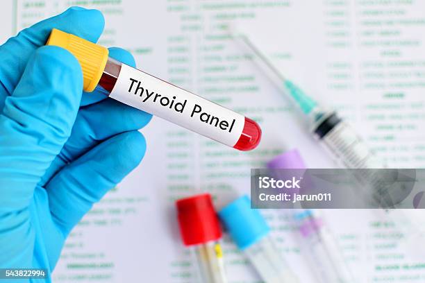 Thyroid Panel Test Stock Photo - Download Image Now - Blood, Blood Test, Endocrine System