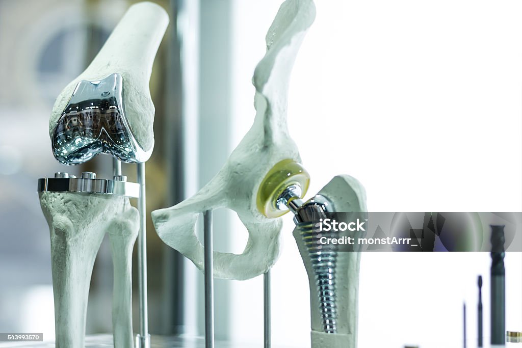 Knee and hip prosthesis Modern knee and hip prosthesis made by cad engineer and manufactured by 3d printing Implant Stock Photo