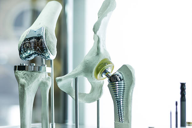proteza kolana i stawu biodrowego - titanium zdjęcia i obrazy z banku zdjęć