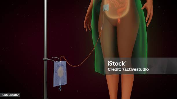 Peritoneal Dialysis Stock Photo - Download Image Now - Peritoneal Dialysis, Anatomy, Bag