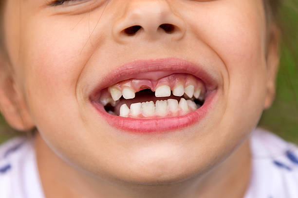 Little girl fell a baby tooth Little girl fell a baby tooth. Child's mouth with hole between the teeth. Shallow dept of field gap toothed photos stock pictures, royalty-free photos & images