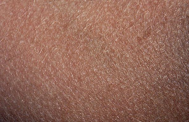 Human skin with hair.