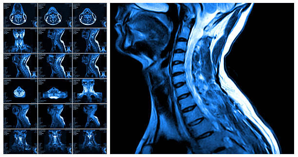 Magnetic resonance imaging of the cervical spine. Magnetic resonance imaging of the cervical spine. MRI vertebral discs in different views cervical vertebrae photos stock pictures, royalty-free photos & images