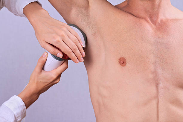 istock Laser hair removal for men 545284678