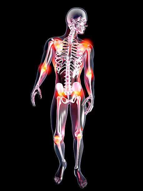 istock Anatomy - Painful Joints 545364348