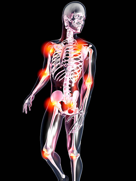 istock Anatomy - Painful Joints 545370996