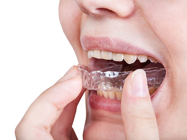 istock girl fixes aligner for orthodontic correction 545434404