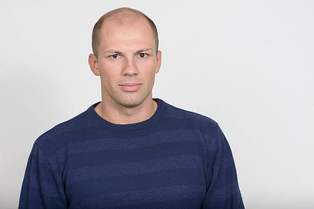 istock Studio portrait of balding young man 545449684
