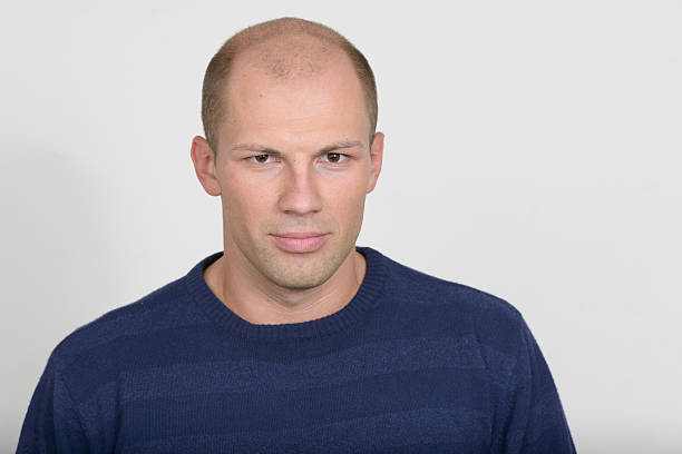 istock Studio portrait of balding young man 545449756