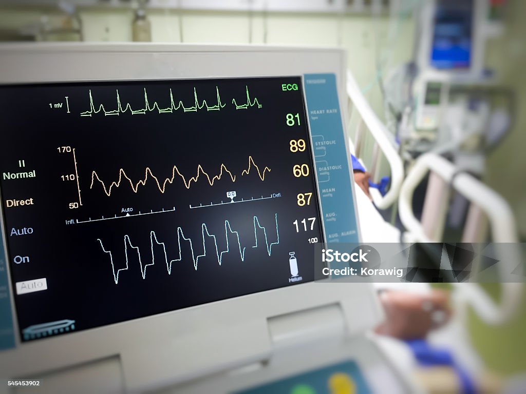 EKG monitor Close up EKG monitor in icu room Electrocardiography Stock Photo