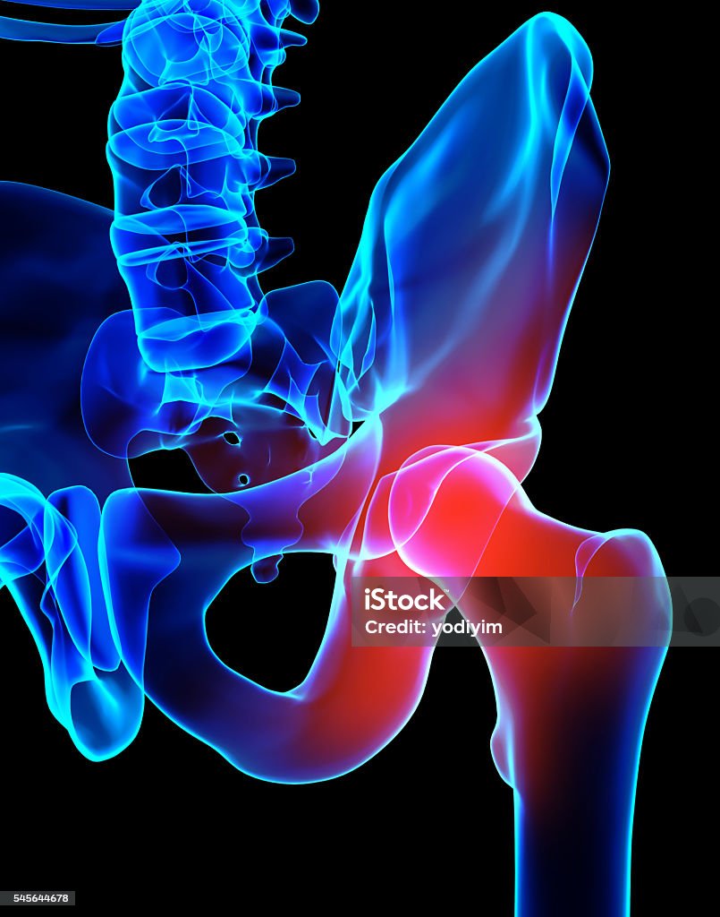Hip painful skeleton x-ray, 3D illustration. 3D illustration, hip painful skeleton x-ray, medical concept. Hip - Body Part Stock Photo