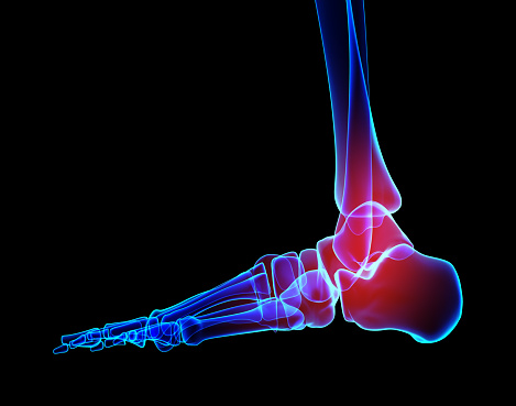 Ankle painful - skeleton x-ray, 3D Illustration medical concept.