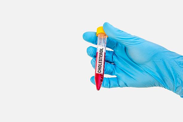 istock Test-tube with blood sample for CHOLESTEROL test 545677904