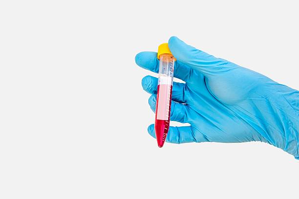 istock Test-tube with blood sample for blank label 545677962