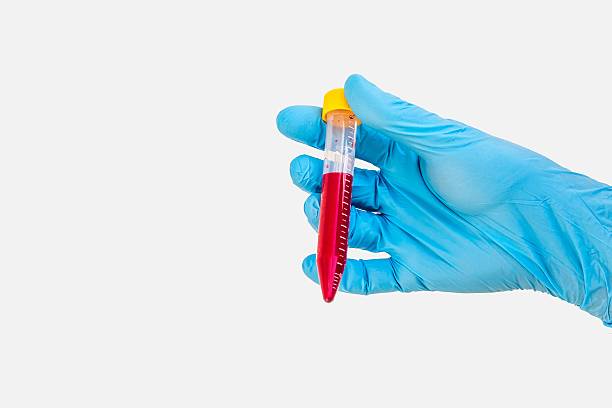 istock Test-tube in hand with blood 545679422