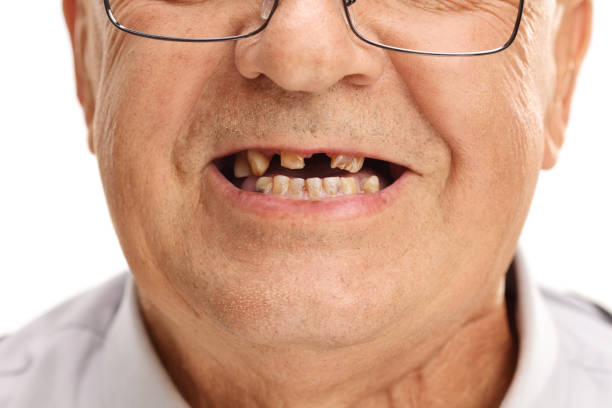 Mouth of a senior with broken teeth Close-up studio shot on a mouth of a senior man with a few broken teeth isolated on white background gap toothed stock pictures, royalty-free photos & images