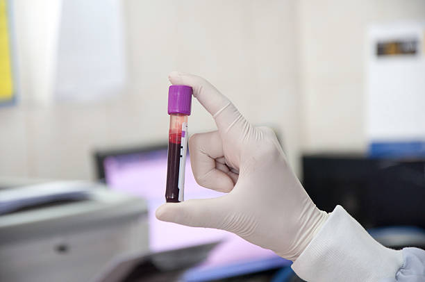 Hand holding test tube with blood plasma ready for testing Hand holding test tube with blood plasma ready for testing technology office equipment laboratory stock pictures, royalty-free photos & images