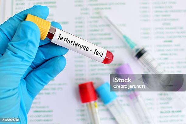 Testosterone Test Stock Photo - Download Image Now - Testosterone, Men, Hormone