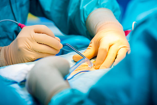 chirurdzy ręce podczas pracy ich pacient z poważnym urazem - pacient zdjęcia i obrazy z banku zdjęć