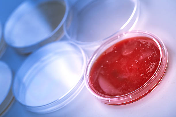 rot ernährung mit agar in petrischale - blood agar stock-fotos und bilder