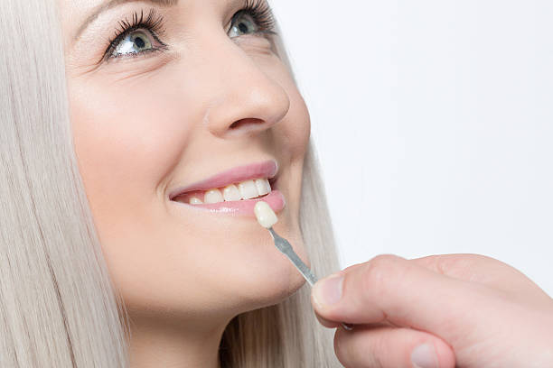 istock check veneer of tooth crown 547152184