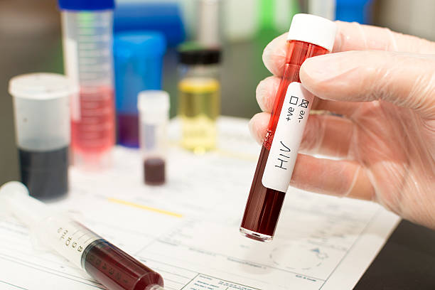 HIV - blood in a test tube Holding a test tube with blood in it. Handwritten label with HIV on it with the negative tick box crossed. hiv photos stock pictures, royalty-free photos & images