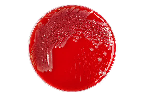 istock Salmonella enteritidis bacterial colonies on blood agar plate is 564589854