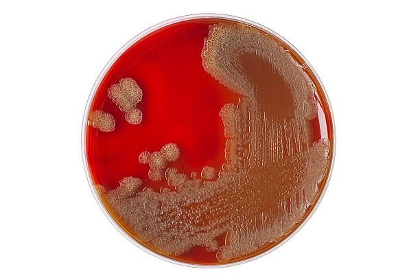 colonies bactériennes de vibrio cholerae sur incubation sur plaque de gélose sanguine - serotype photos et images de collection