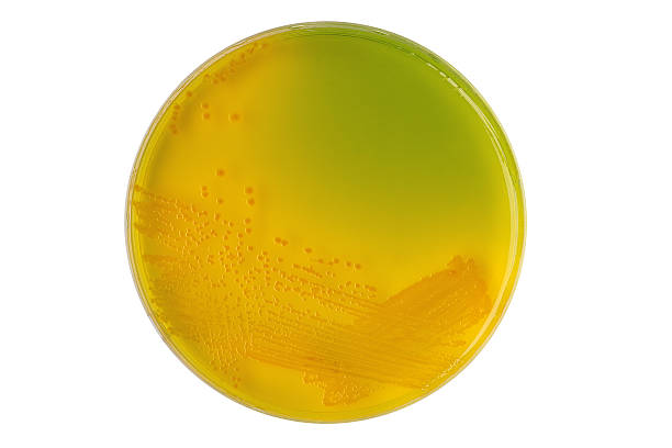 tcbs 선택적 매체 에 비브리오 콜레라 세균 식민지 - cholera bacterium 뉴스 사진 이미지