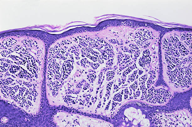 haut weg - wissenschaftliche mikroskopische aufnahme stock-fotos und bilder