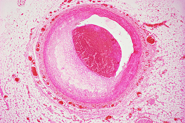 коронарная артерия - scientific micrograph стоковые фото и изображения